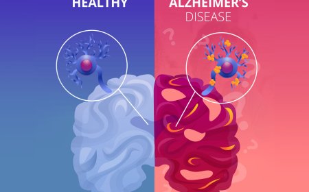 ALZHEIMER'S DISEASE